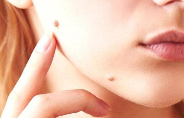 روانشناسی خال های روی بدن | داشتن خال روی بدن به چه معناست؟ روانشناسی خال های روی بدن | داشتن خال روی بدن به چه معناست؟