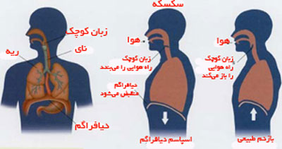 اگر دچار سکسکه شدیم راه درمانش چیست؟