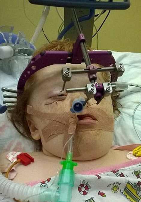 دختری با صورت از هم پاشیده و بدنی عجیب + عکس