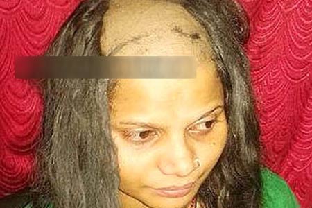 کچل شدن دختر بیچاره به وسیله برادرش + عکس