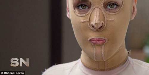عکس های تکان دهنده از جراحی پلاستیک صورت سوخته زن
