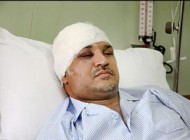 ستارگانی که گرفتار سوانح رانندگی شدند +عکس