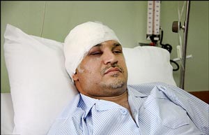 ستارگانی که گرفتار سوانح رانندگی شدند +عکس