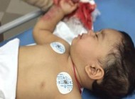 قطع شدن ناگوار انگشتان نوزادی در آسانسور +عکس(+16)