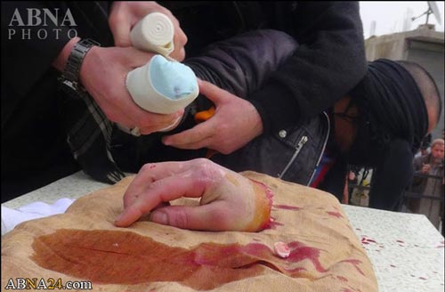 گروه تروریستی داعش دست جوان سوری را قطع کرد + (عکس ۱۸+)