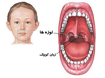 به چه دلیل زبان کوچک،بزرگ می شود؟ +عکس