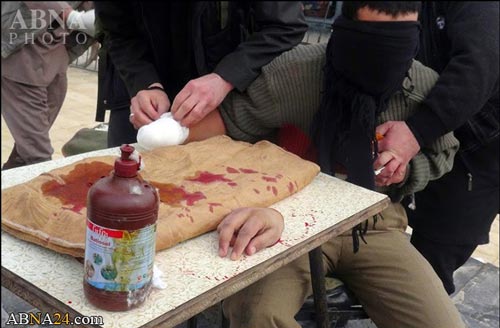 گروه تروریستی داعش دست جوان سوری را قطع کرد + (عکس ۱۸+)