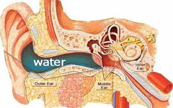 دلایل ایجاد زخم در گوش انسان چیست؟