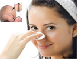 از بین بردن دانه ای سیاه روی بینی