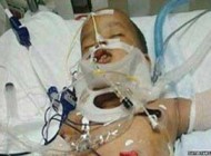 زنده ماندن عجیب کودک 1 ساله پس از سقوط از ساختمان 11 طبقه