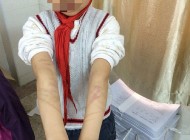 عکس های تنبیه وحشیانه با میله‌ آهنی و لوله و طناب‌بازی +18