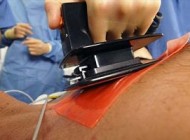 پسر 18 ساله پس از اصابت 10 گلوله از مرگ برگشت