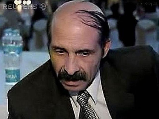 تصاویر طنز وقتی آدم کچل باشه مجبور موهاشو اینجوری بزنه
