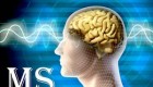 بازیگر جوان و زیبای ایرانی مبتلا به بیماری MS شد + عکس