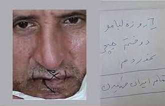 بازیکن مشهور پرسپولیس در اعتراض به فساد دهانش را دوخت +عکس