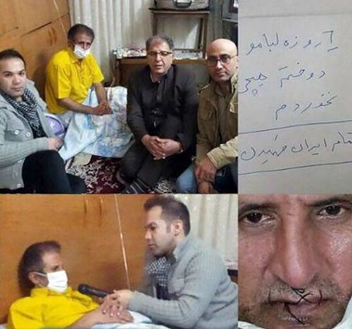 بازیکن مشهور پرسپولیس در اعتراض به فساد دهانش را دوخت +عکس