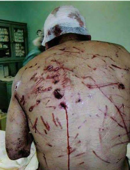 نجات معجزه آسای مرد ایرانی از حمله گرگ + عکس 18+