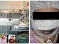 جزئیات فاجعه سوختن مادر 2قلوها در اتاق زایمان +عکس