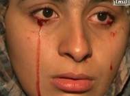 دختری که سنگ گریه می کند! + تصویر