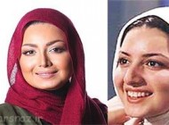 تصاویر جالب قبل و بعد از عمل بازیگران