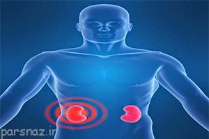 بیماری کلیوی و نشانه های آن را بهتر بشناسیم