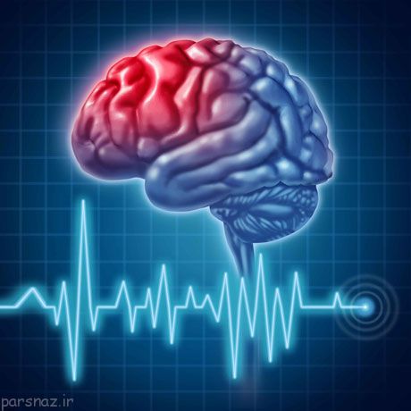 علائم هشدار دهنده سکته مغزی را بدانید