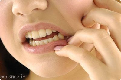 این عادات موجب خراب شدن دندان ها می شوند
