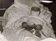 داستان عمل جراحی جنجالی و عجیب