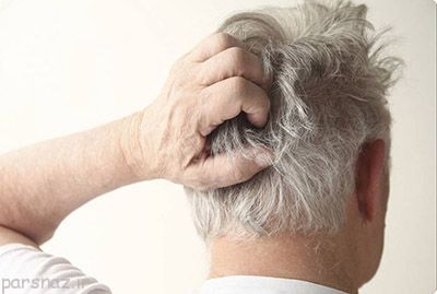 چرا پوست سر ما خارش میگیرد؟ چرا پوست سر ما خارش میگیرد؟