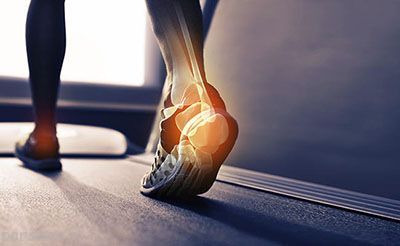 دلایل آسیب دیدن مچ پا هنگام پیاده روی
