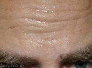 بوی بد عرق اشکال از کجاست؟