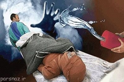 اسید پاشی و روایت های تلخ