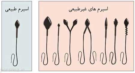 آزمایش اسپرم در مردان چگونه است؟