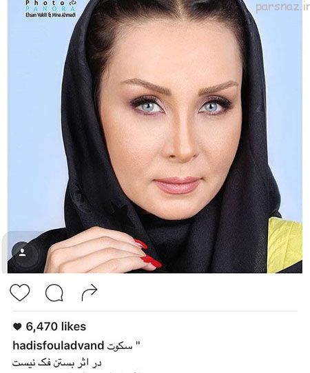 عکسهای داغ بازیگران و ستاره های کشورمان