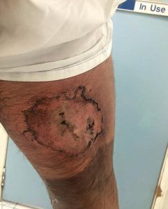 ببینید گوشی آیفون با این مرد چه کرده +عکس