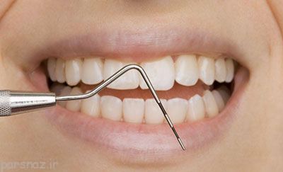 بیماری های لثه را جدی بگیریم