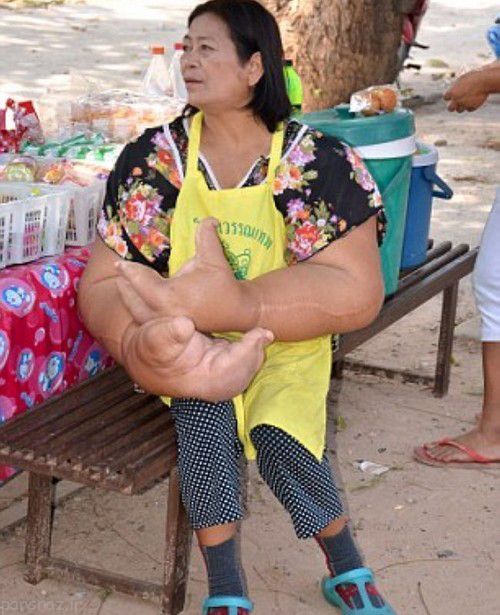 دستان بزرگ این زن تایلندی رسانه ای شد
