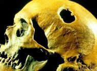 جمجمه های مته کاری شده اجداد ما