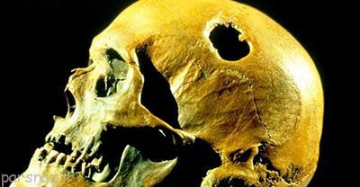 جمجمه های مته کاری شده اجداد ما