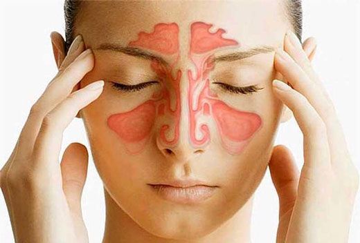 با بیماری سینوزیت مقابله کنید