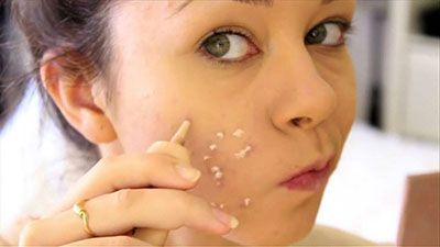ترفند آرایشی پنهان کردن جای زخم