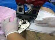 بزرگ کردن آلت تناسلی آقایان با حلقه جنسی +عکس
