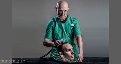 پیوند سر انسان و مشکلات پیش رو