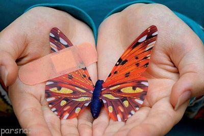 بیماری ای بی EB و پوست های شکننده