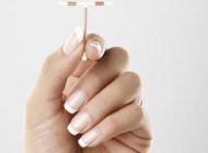 تاثیرات کار گذاشتن IUD برای جلوگیری از بارداری