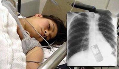 دلیل بلعیدن گوشی موبایل توسط این دختر