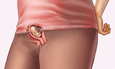 وضعیت مادر و جنین در هفته هفتم بارداری وضعیت مادر و جنین در هفته هفتم بارداری