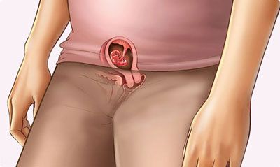 وضعیت مادر و جنین در هفته پنجم بارداری وضعیت مادر و جنین در هفته پنجم بارداری