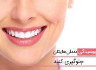 با این روش ها دندان را از پوسیدگی نجات دهید