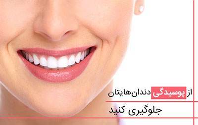 با این روش ها دندان را از پوسیدگی نجات دهید